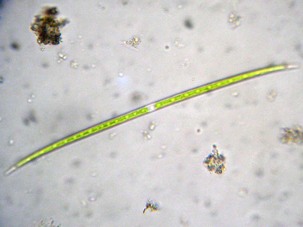 Closterium gracile?